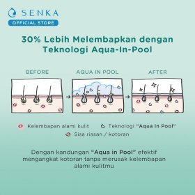 Perfect Whip Acne Care (50g)