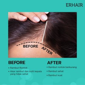 Hairgrow Tonic All Hair Type (60ml)