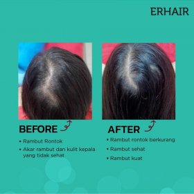 [GIFT] ERHA Hair Tonic Cover Lama (60ml)