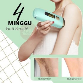IPL Hair Removal Epilator Tubuh (Biru Muda)